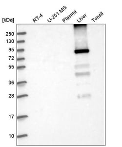 Glycogen synthase 2 Antibody, Novus Biologicals 0.1mL; Unlabeled:Antibodies,